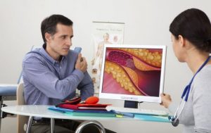 Erkek bir hastasına kolesterolu gösteren bayan bir doktor.