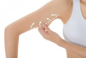 Sarkıklık ve Gevşeklikler, Diyet ve Egzersizle Giderilebilir