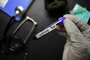 Kreatinin Sağlığınıza Zararlı mı?